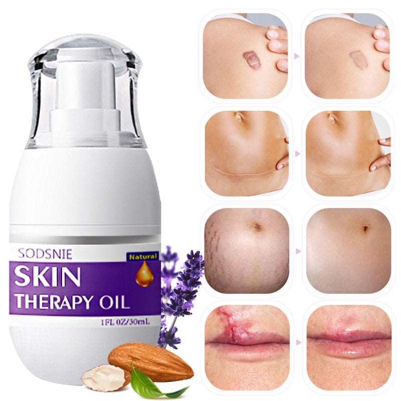 Skin treatment oil for appearance of scarts and sellulite