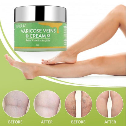 Sefudun foot varicose veins repair cream